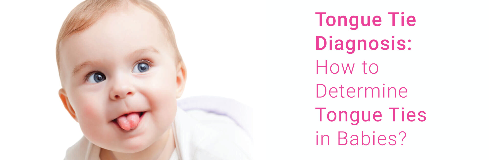 TONGUE TIE DIAGNOSIS: HOW TO DETERMINE TONGUE TIES IN BABIES?