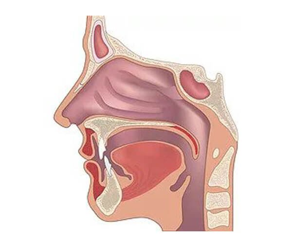 airway