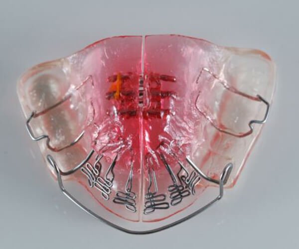 Why Is Airway Orthodontics Necessary To Align Your Teeth? | | TMJ, Tongue Tie & Sleep Institute – Tongue Tie Treatment in Mumbai, India | Myofunctional therapy |