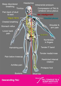Descending TMJ