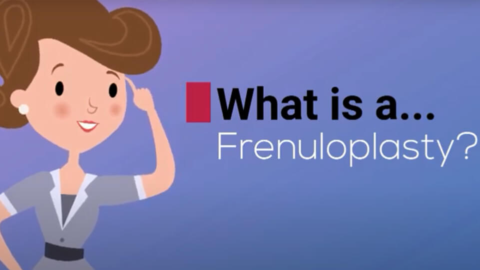 Frenuloplasty Functional
