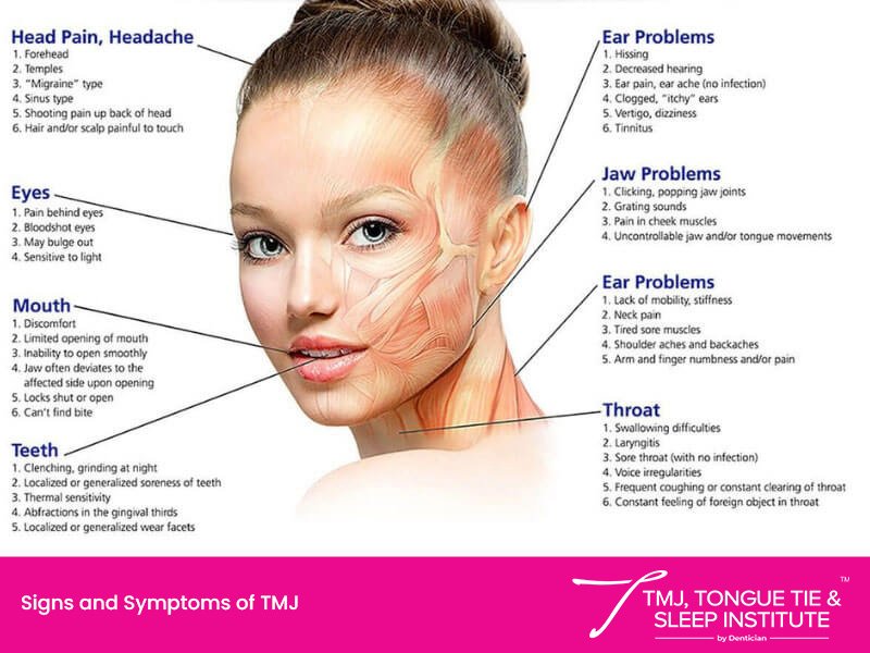 sign symtoms of headache