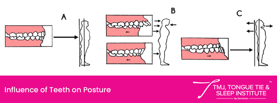 Airway Orthodontics | | TMJ, Tongue Tie & Sleep Institute – Tongue Tie Treatment in Mumbai, India | |