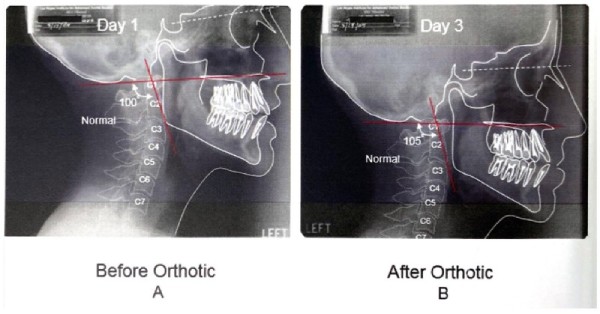 GNM Orthotics | | TMJ, Tongue Tie & Sleep Institute – Tongue Tie Treatment in Mumbai, India | |