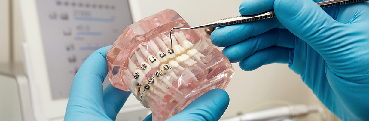 7 Reasons To Get Braces As An Adult | | TMJ, Tongue Tie & Sleep Institute – Tongue Tie Treatment in Mumbai, India 7 Reasons To Get Braces As An Adult | | TMJ, Tongue Tie & Sleep Institute – Tongue Tie Treatment in Mumbai, India | Myofunctional therapy |