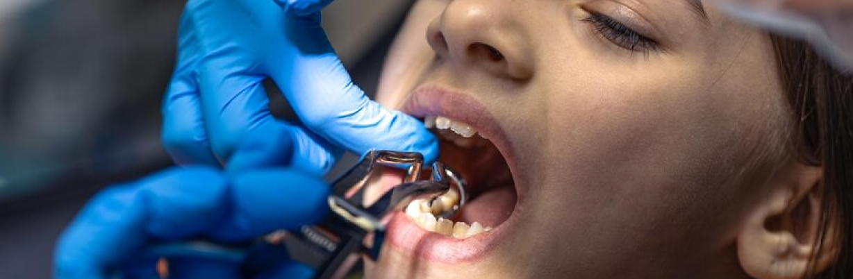 3 Methods To Test If Your Child Is Habitually Mouth Breathing | | TMJ, Tongue Tie & Sleep Institute – Tongue Tie Treatment in Mumbai, India 3 Methods To Test If Your Child Is Habitually Mouth Breathing | | TMJ, Tongue Tie & Sleep Institute – Tongue Tie Treatment in Mumbai, India | Myofunctional therapy |