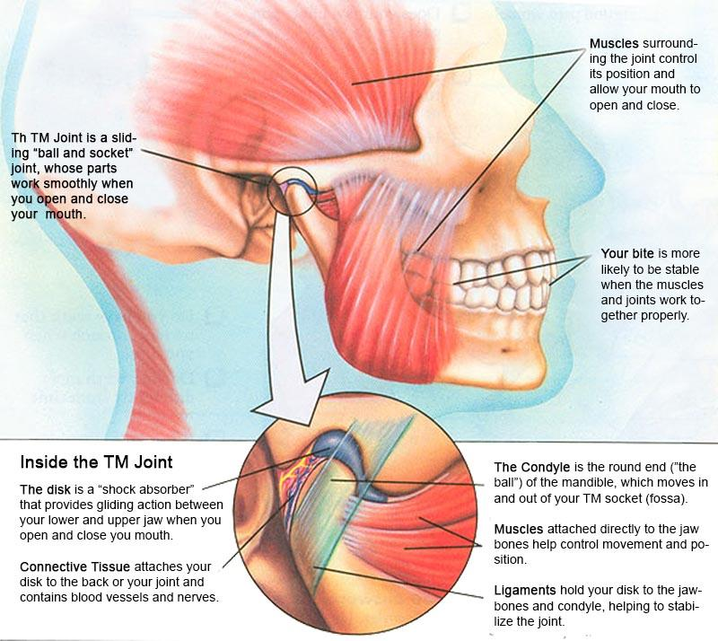 Can TMJ Disorder Be Considered a Neurological Issue? | | TMJ, Tongue Tie & Sleep Institute – Tongue Tie Treatment in Mumbai, India | TMJ |