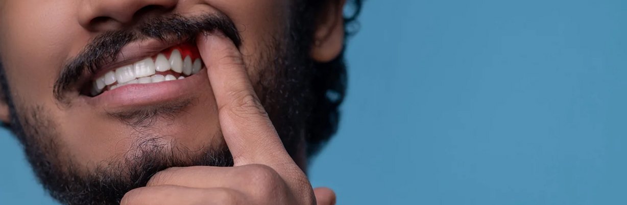 How Missing Teeth Affect Jaw, Posture, and Airway