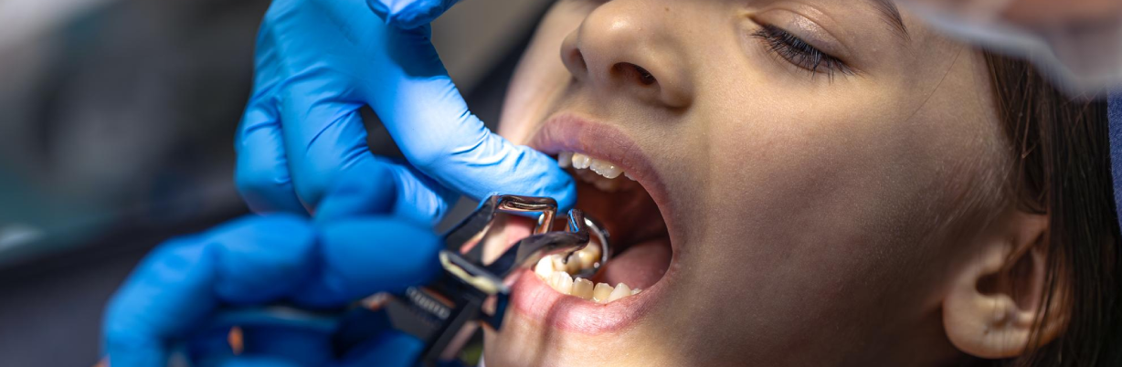 Girl in the dentists office dentist examining child patients teeth dentistry conce