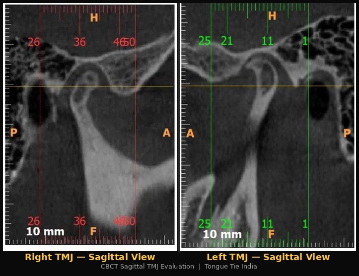 Digital & At-Home TMJ Diagnosis in India: The Rise of Virtual Jaw Rehabilitation | | TMJ, Tongue Tie & Sleep Institute – Tongue Tie Treatment in Mumbai, India | TMJ |