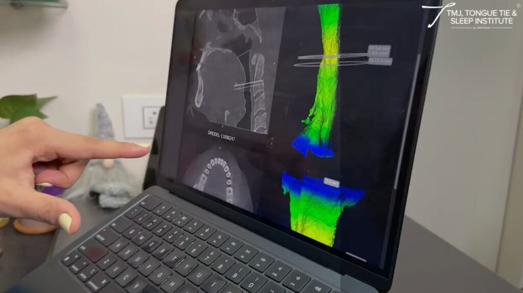 Digital & At-Home TMJ Diagnosis in India: The Rise of Virtual Jaw Rehabilitation | | TMJ, Tongue Tie & Sleep Institute – Tongue Tie Treatment in Mumbai, India | TMJ |