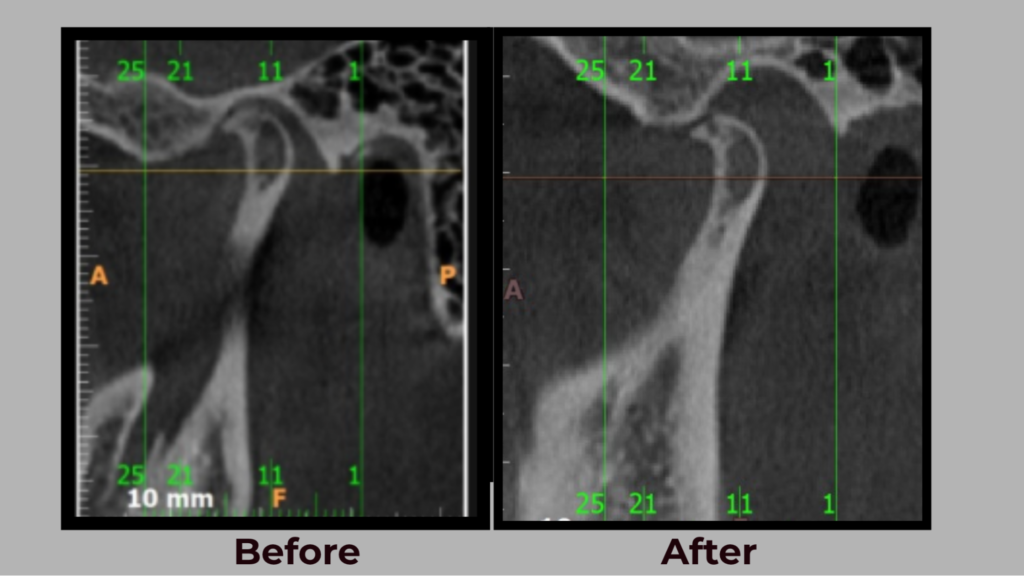 Digital & At-Home TMJ Diagnosis in India: The Rise of Virtual Jaw Rehabilitation | | TMJ, Tongue Tie & Sleep Institute – Tongue Tie Treatment in Mumbai, India | TMJ |